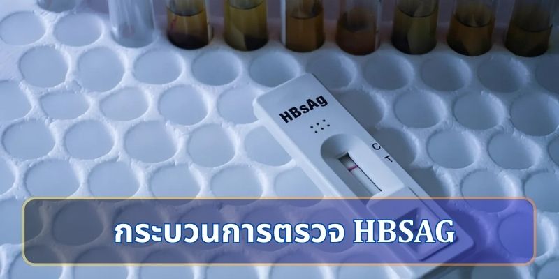 กระบวนการตรวจ HBsAg