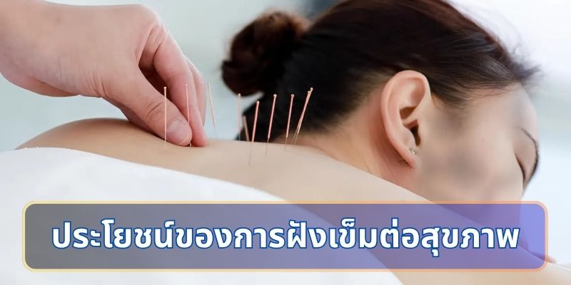 ประโยชน์ของการฝังเข็มต่อสุขภาพ